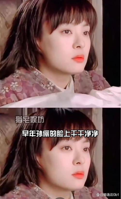 2025澳门全年資料免費大全和孙俪唇下痣没了与孙俪嘴唇的痣